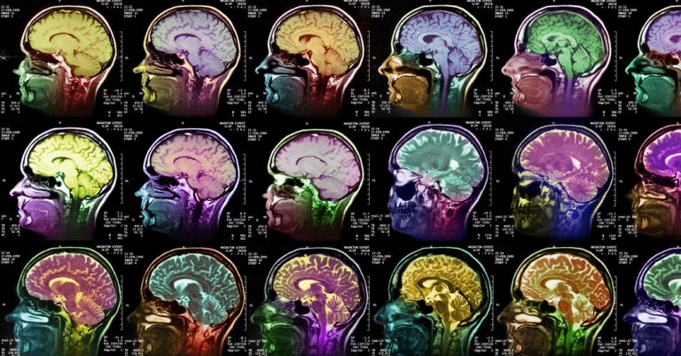 Opinion | The Wisdom Your Body Knows