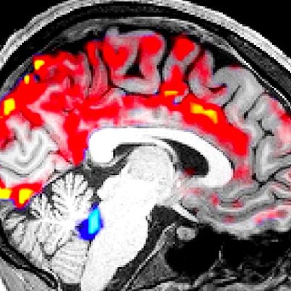 Scientists discovered how this fluid cleans your brain as you sleep, removing to…
